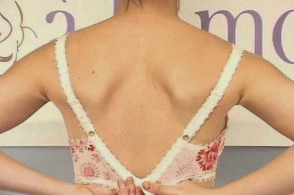 How to Wear a Bra Properly; Adjust the straps to fit properly